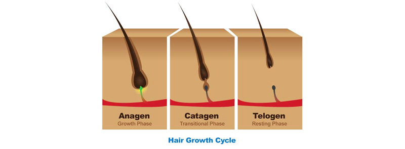 telogen-effluvium-a-common-form-of-hair-loss